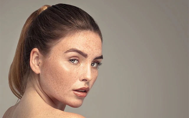 removing face freckles